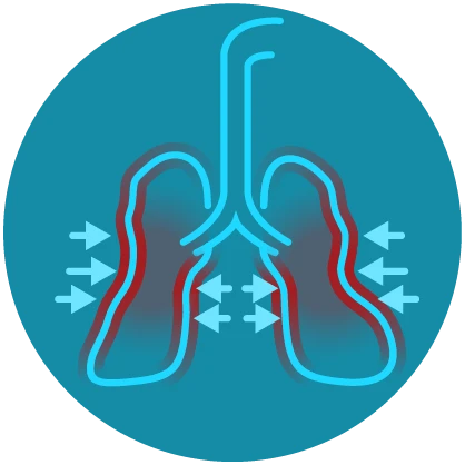 image depicting lungs with restricted air representing shortness of breath